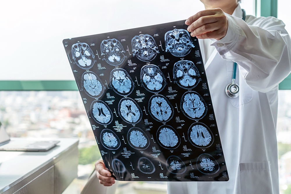 Как снять головную боль без таблеток: 10 проверенных способов