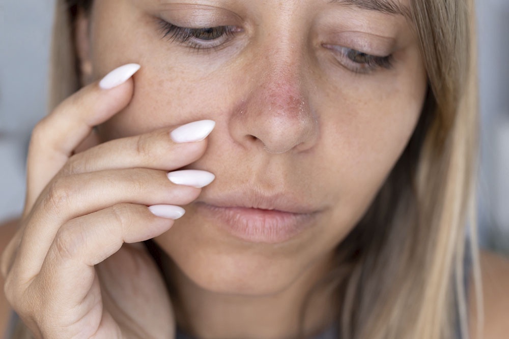 Девушка страдает от проблемы с сухой кожей в зимнее время