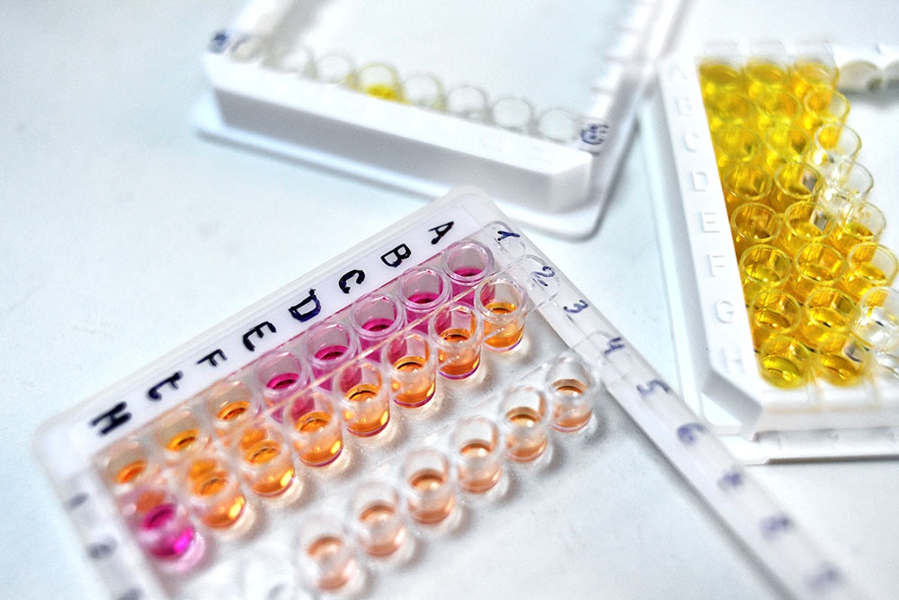 Приготовление гомогената клещей для проведения иммуноферментного анализа во время исследования иксодовых клещей на наличие вирусного энцефалита и болезни Лайма.