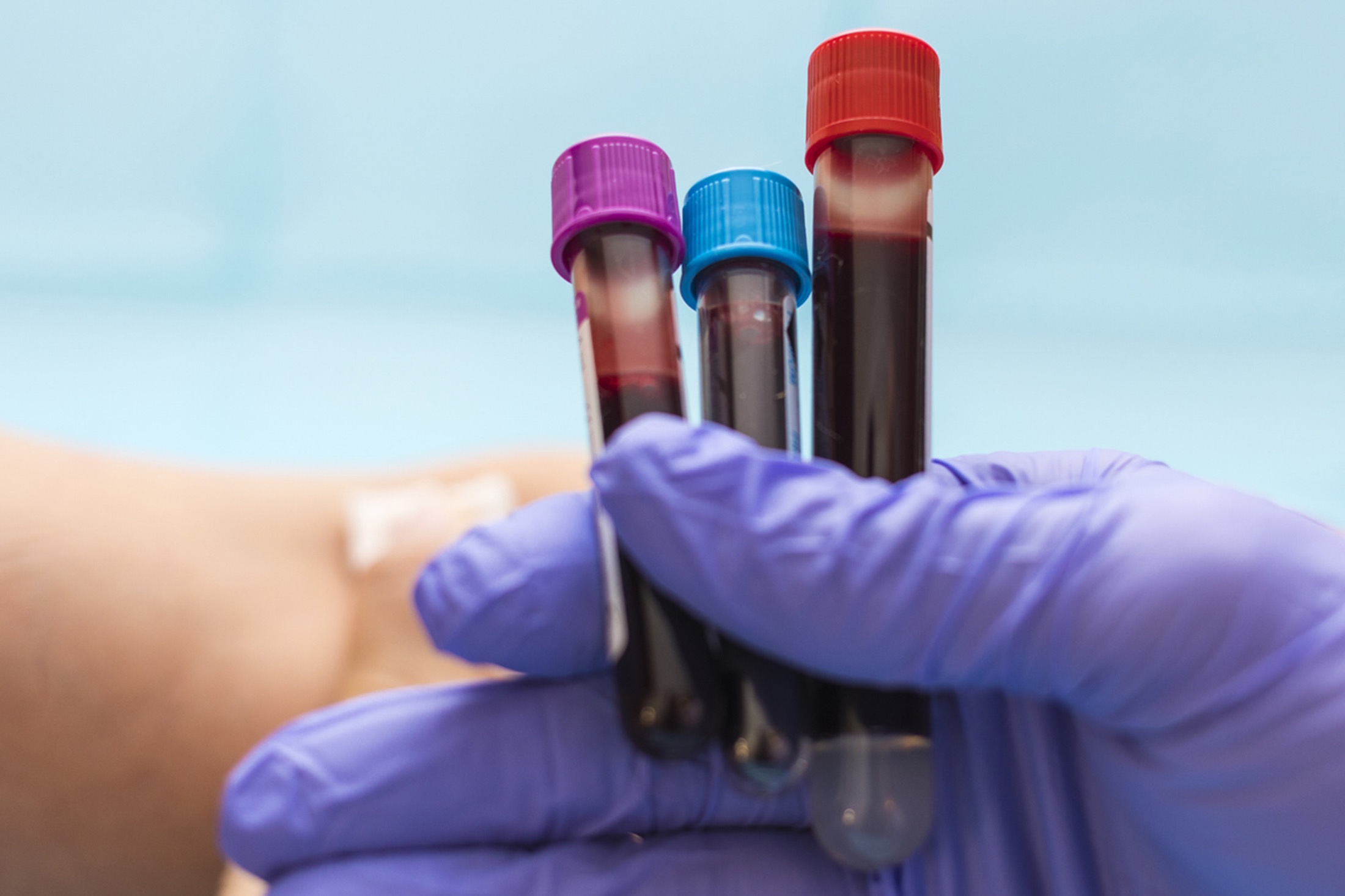 Хеликобактер пилори: как узнать, есть ли инфекция, и когда идти к врачу