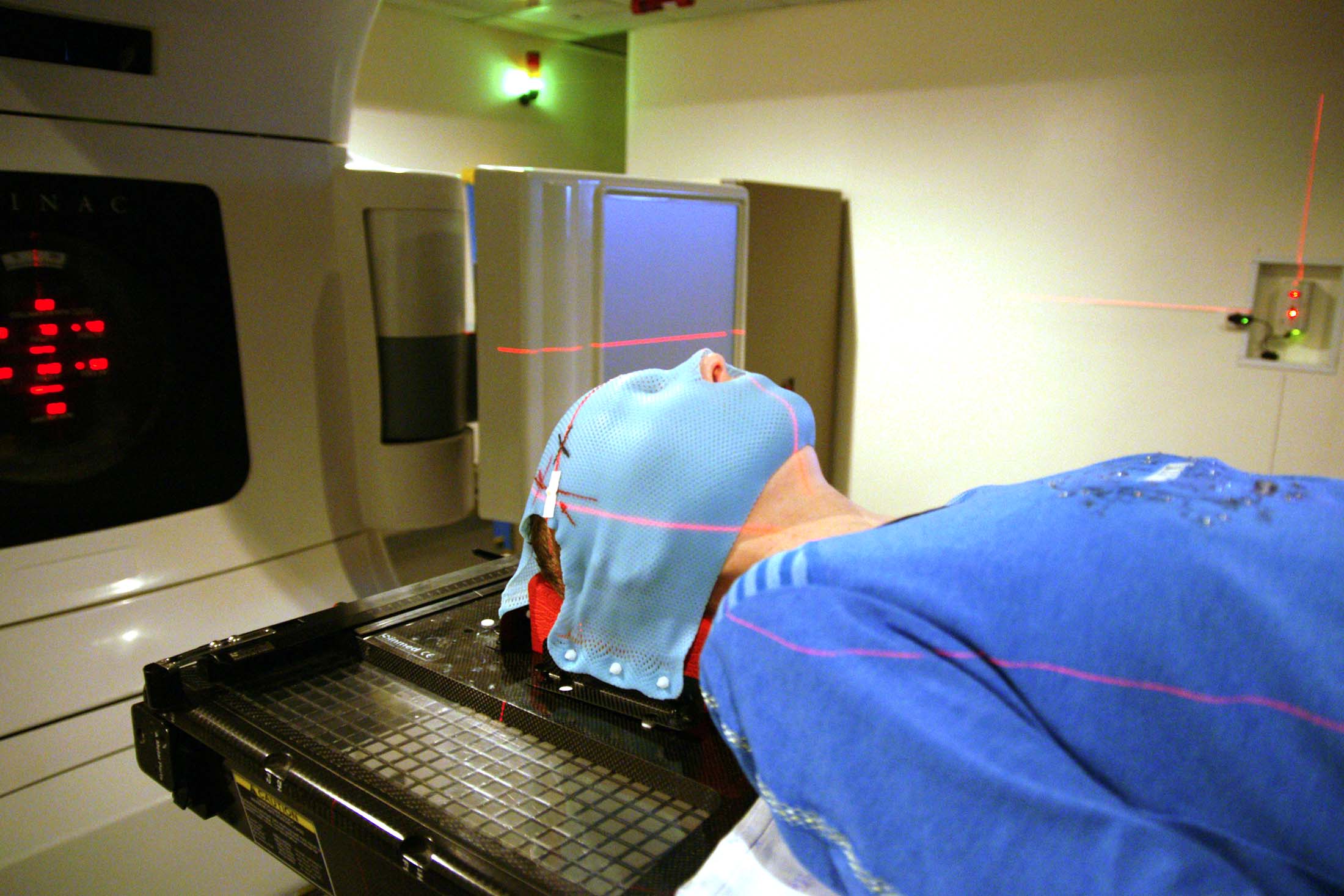 сеанс лучевой терапии