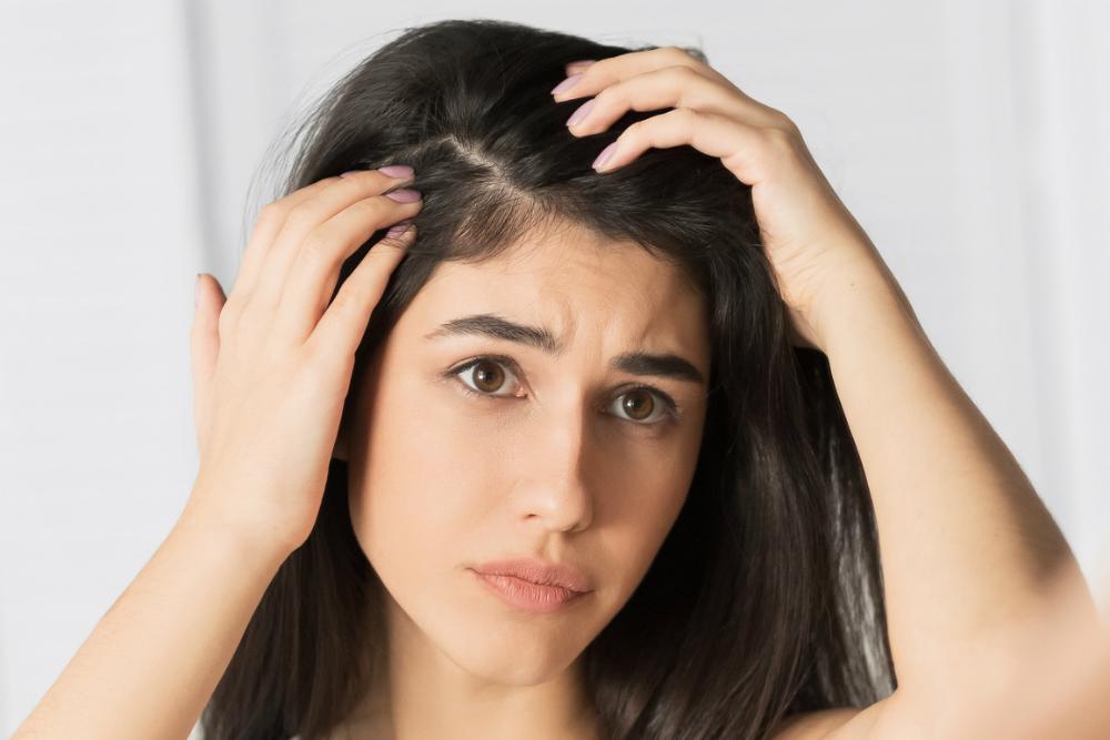 Британские ученые назвали перхоть признаком опасной болезни ...