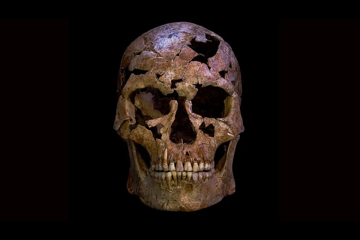 Череп мужчины, погибшего 12 000 лет назад на территории современного Вьетнама. Лишнее ребро находилось у него в области шеи. Череп мужчины, погибшего 12 000 лет назад на территории современного Вьетнама. Лишнее ребро находилось у него в области шеи.