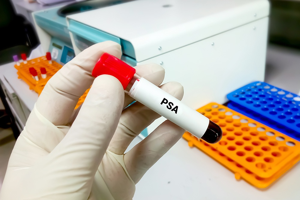 Несложные анализы крови, инструментальные исследования укажут на высокий риск опухоли.