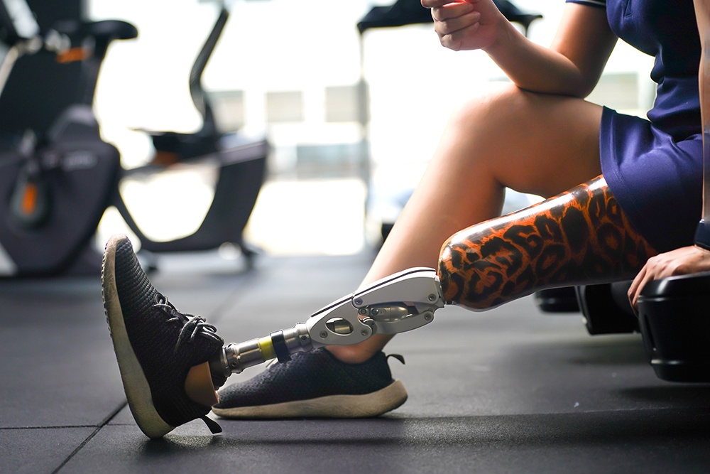 Современные бионические протезы позволяют вернуться к полноценной жизни.