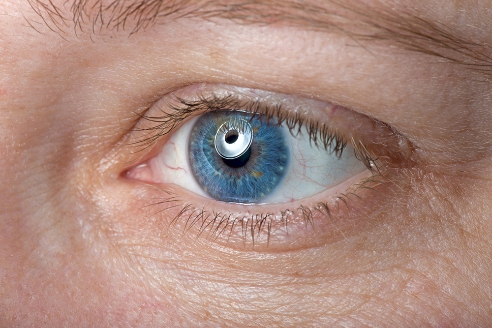 Что представляет собой вживляемый в глаз имплант PRIMA, который возвращает зрение слепым