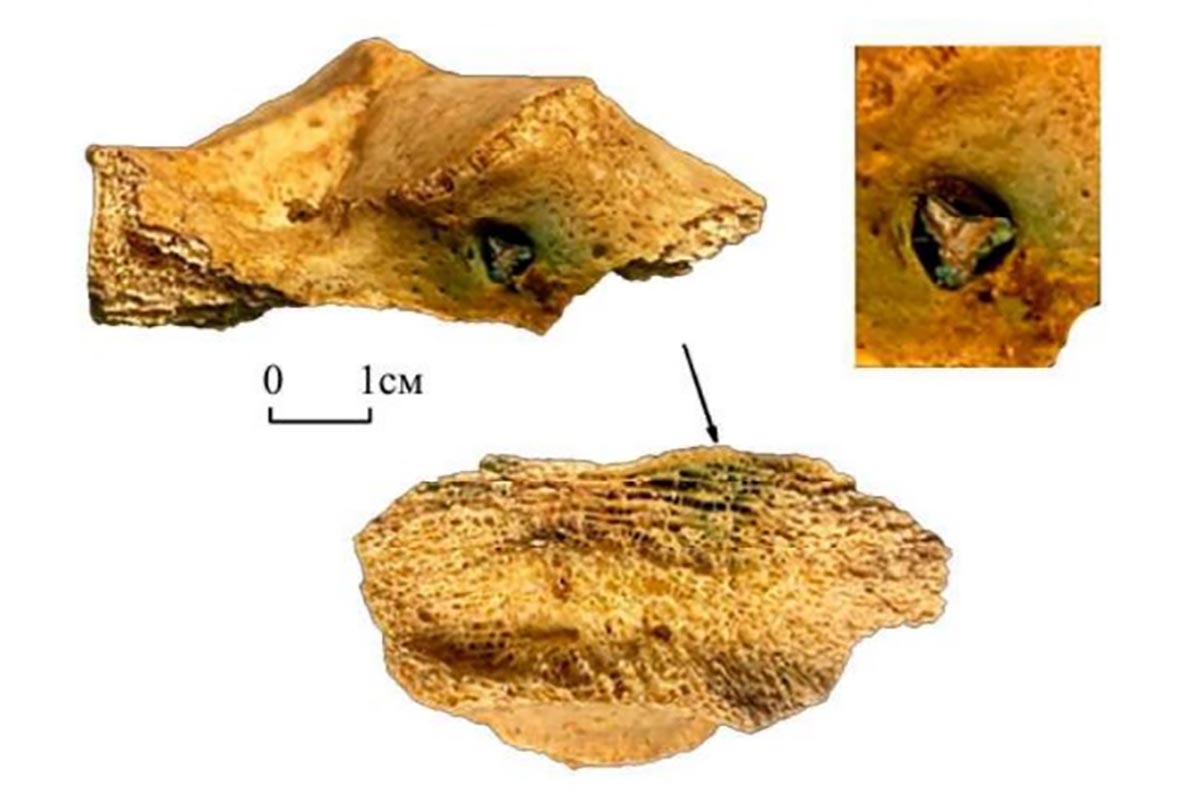 После ранения мужчина выжил. Но травма давала о себе знать.