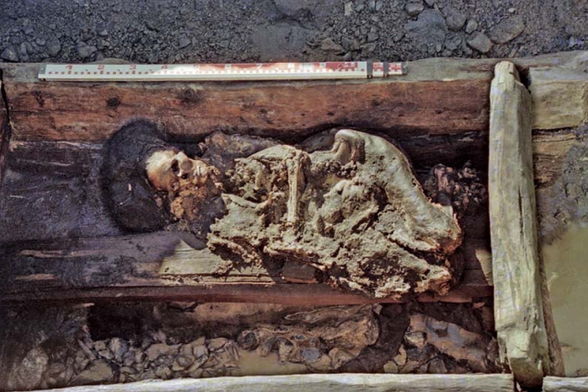 Вид на погребение женщины в могильнике Верх-Кальджин II. При жизни она была успешно прооперирована по поводу вывиха височно-нижнечелюстного сустава.