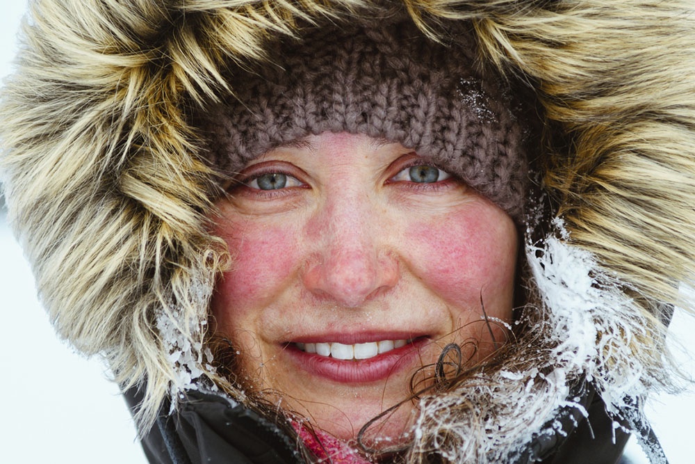 Девушка с красным обветренным лицом зимой
