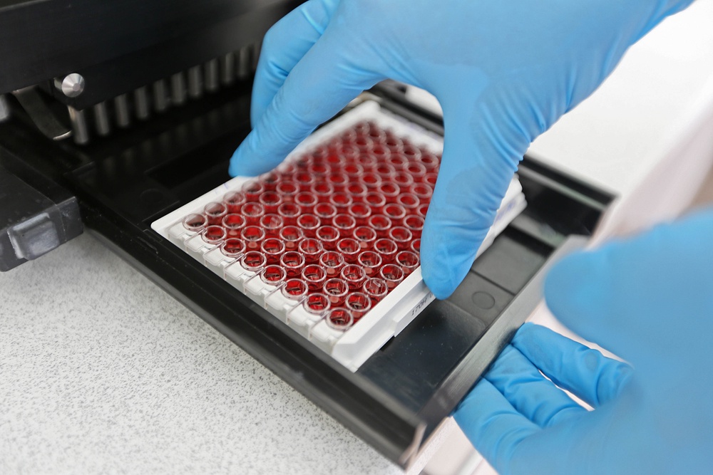 Чаще всего у северян выявляют рак молочной железы и толстого кишечника, а также меланому.