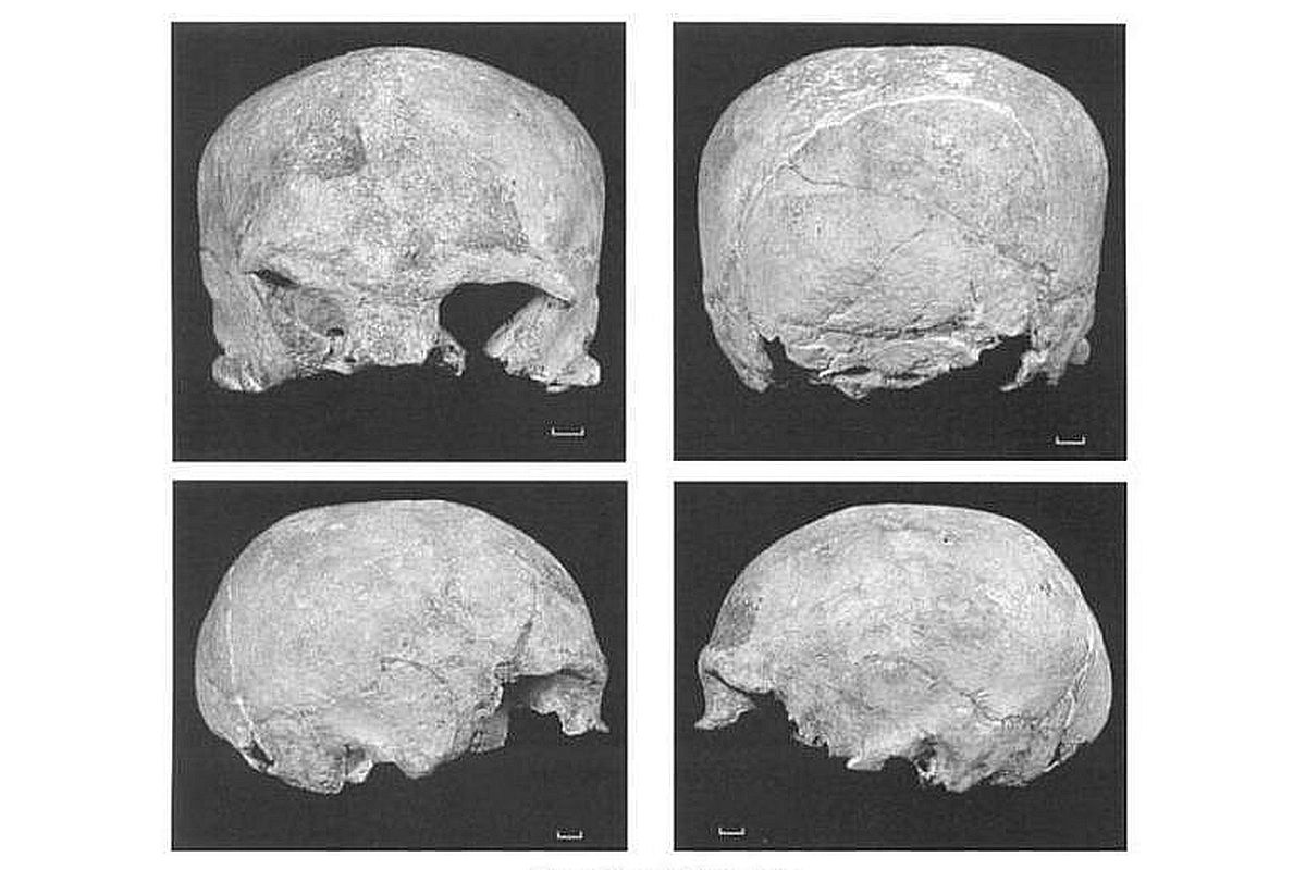 Над возрастом этого древнего черепа из Синги 100 лет ломали голову ученые. Над возрастом этого древнего черепа из Синги 100 лет ломали голову ученые.