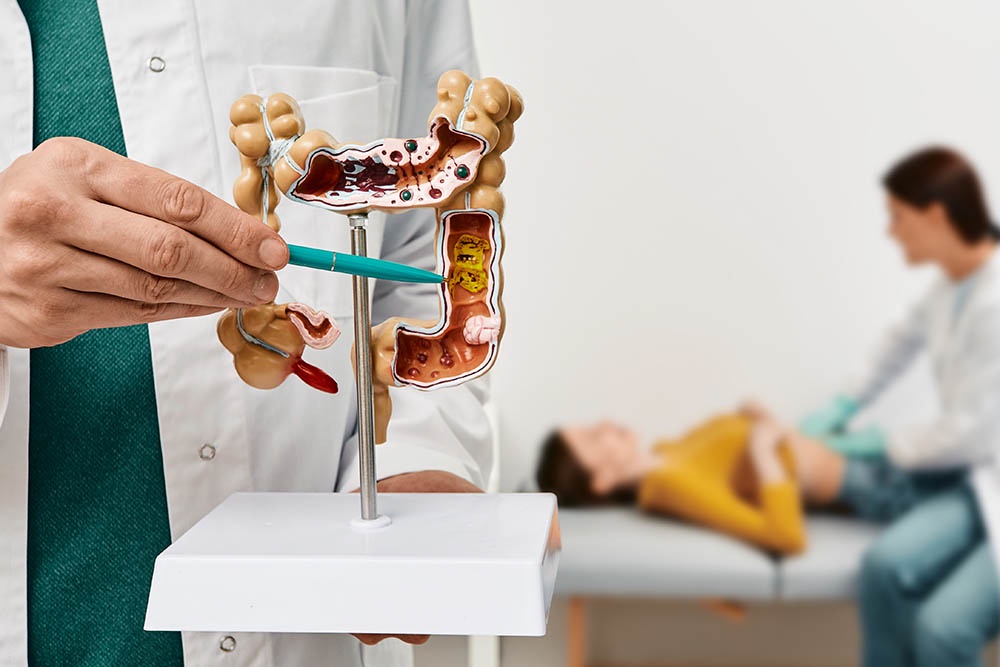 От появления полипа до перерождения его в рак может пройти более десяти лет.