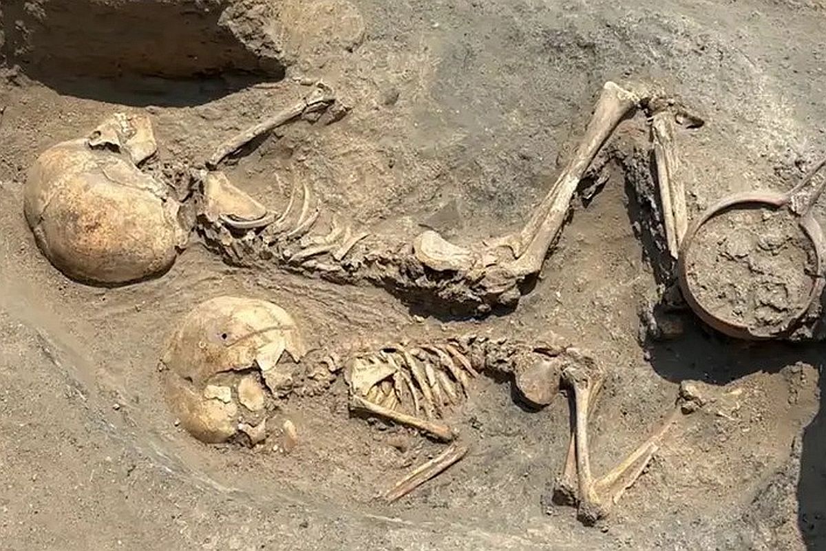 На черепе ребенка возрастом 4000 лет есть следы трепанации. Это делает его старейшим из известных свидетельств хирургических операций в Центральной Азии.