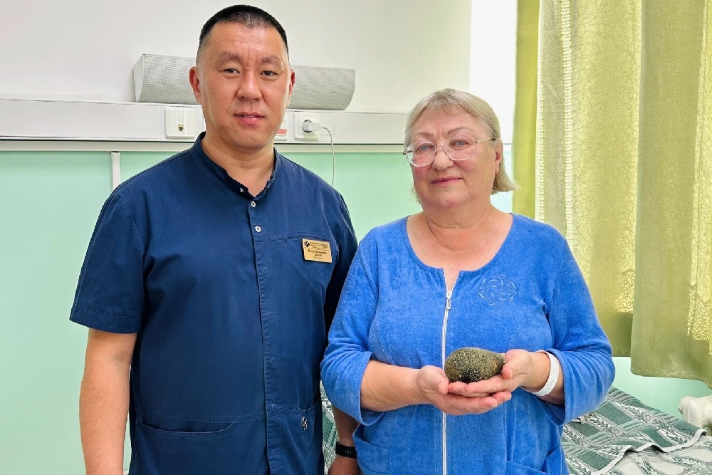 В руках у пациентки рекордный желчный камень. В руках у пациентки рекордный желчный камень.
